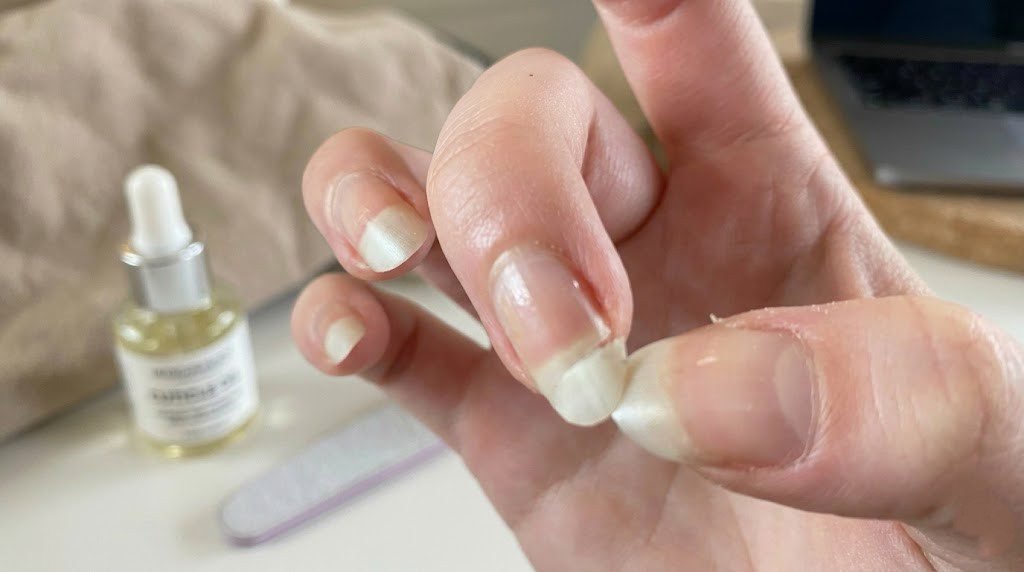 short natural nails being examined close up with cuticle oil dropper bottle and nail file in background